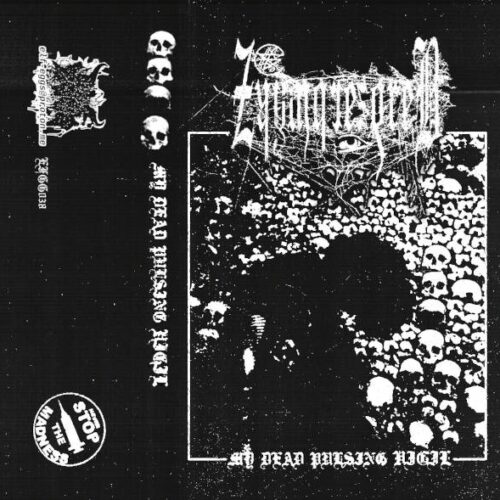 Zkywbrezdreb – "My Dead Pulsing Vigil" Tape
