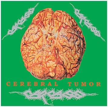 Carcass-Cerebral1 Carcass - "Cerebral Tumor - Brainswashing Live In Dortmund, Germany, 30/07/90" 2LP