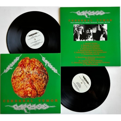 Carcass-Cerebral2 Carcass - "Cerebral Tumor - Brainswashing Live In Dortmund, Germany, 30/07/90" 2LP