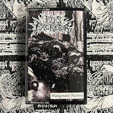 Pus Excretor - Malignant Pustule tape Pus Excretor - "Malignant Pustule" Tape